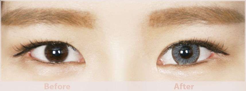 gray toric circle lens for astigmatism before and after